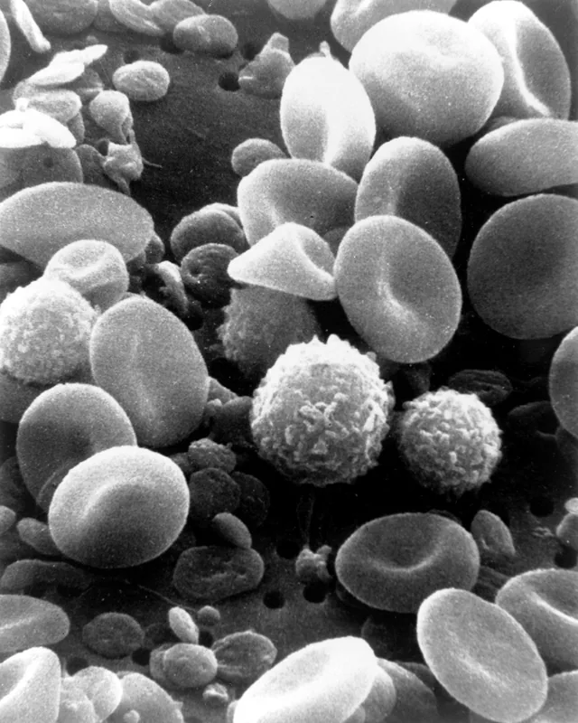Real human blood cells seen through an electron microscope.